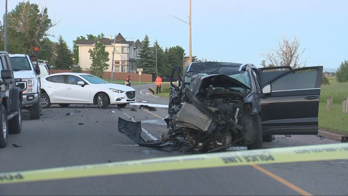 70-Year-Old Woman Suffers Life-Altering Injuries After Being Hit by Car in Southwest Calgary
